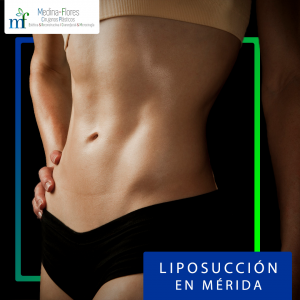 Liposucción en Mérida