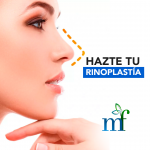 Rinoplastia Medina