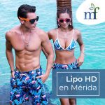 Lipo HD en Mérida