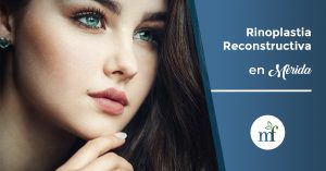 rinoplastia reconstructiva en Mérida