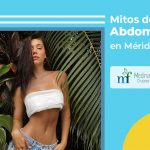 abdominoplastia en Mérida