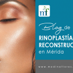 rinoplastia reconstructiva en Mérida