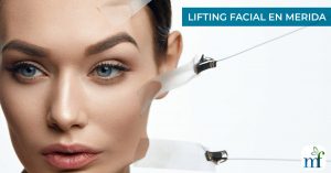 Lifting Facial en Mérida