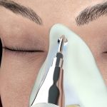 Rinoplastia Ultrasonica en Merida